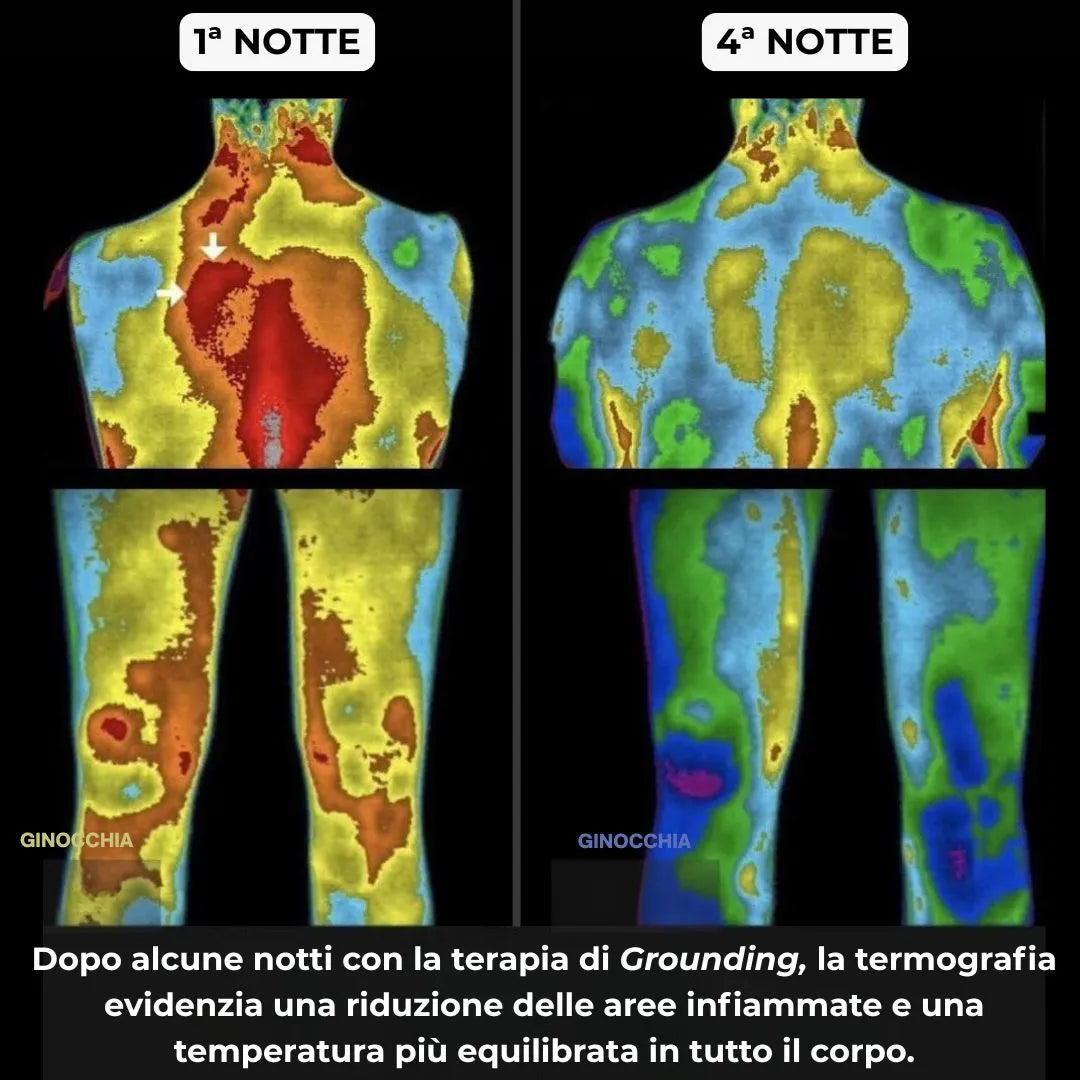 Radika™ - Lenzuolo Terapeutico per Dormire Meglio Senza Cambiare Abitudini.